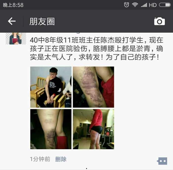 临沂好邻居爆料视频,邻里纠纷引关注 第2张 临沂好邻居爆料视频,邻里纠纷引关注 第2张
