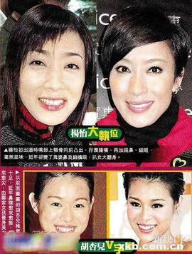 台湾节目爆料整容视频大全,视频大全曝光惊人内幕